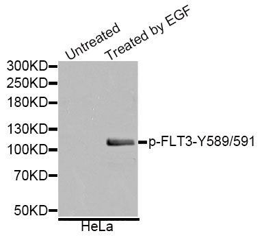 CD135 / FLT3 Antibody - Western blot analysis of extracts of various cell lines.