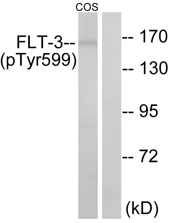 CD135 / FLT3 Antibody - Western blot analysis of lysates from COS7 cells treated with EGF 200ng/ml 30', using FLT3 (Phospho-Tyr599) Antibody. The lane on the right is blocked with the phospho peptide.
