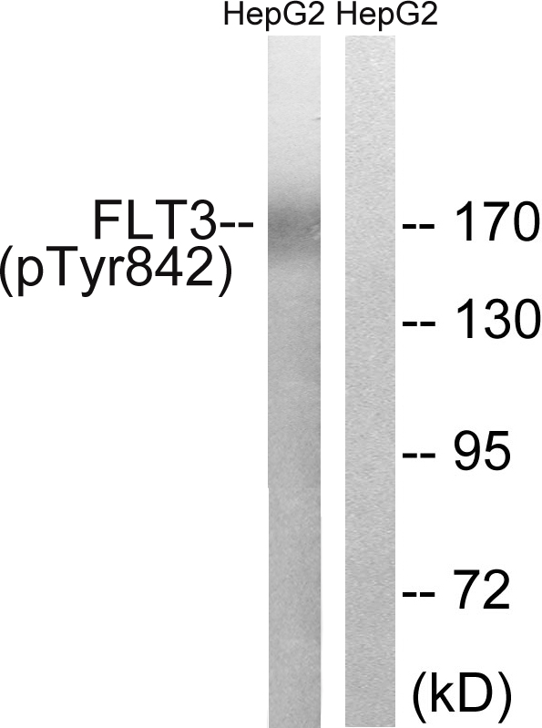 CD135 / FLT3 Antibody - Western blot analysis of lysates from HepG2 cells treated with EGF 200ng/ml 30', using FLT3 (Phospho-Tyr842) Antibody. The lane on the right is blocked with the phospho peptide.