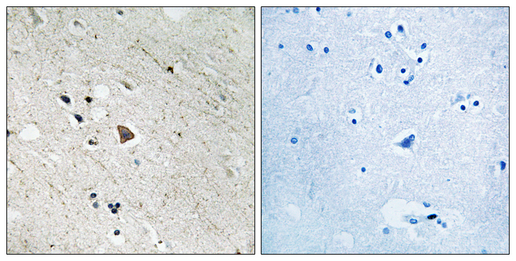 CD135 / FLT3 Antibody - Immunohistochemistry analysis of paraffin-embedded human brain, using FLT3 (Phospho-Tyr969) Antibody. The picture on the right is blocked with the phospho peptide.