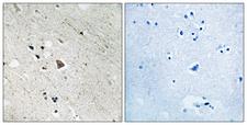 CD135 / FLT3 Antibody - Immunohistochemistry analysis of paraffin-embedded human brain, using FLT3 (Phospho-Tyr969) Antibody. The picture on the right is blocked with the phospho peptide.