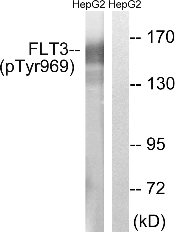 CD135 / FLT3 Antibody - Western blot analysis of lysates from HepG2 cells treated with Na3VO4 0.3mM 40', using FLT3 (Phospho-Tyr969) Antibody. The lane on the right is blocked with the phospho peptide.