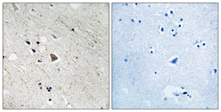 CD135 / FLT3 Antibody - P-peptide - + Immunohistochemistry analysis of paraffin-embedded human brain tissue using FLT3 (Phospho-Tyr969) antibody.