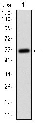 CD14 Antibody - Western blot using CD14 monoclonal antibody against human CD14 (AA: 20-214) recombinant protein. (Expected MW is 46.8 kDa)