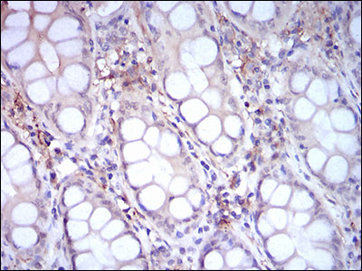 CD14 Antibody - IHC of paraffin-embedded colon tissues using CD14 mouse monoclonal antibody with DAB staining.