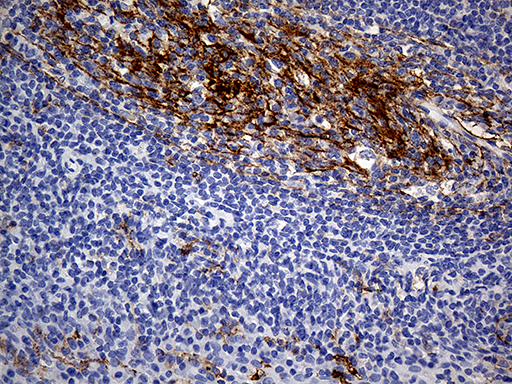 CD14 Antibody - Immunohistochemical staining of paraffin-embedded Human tonsil within the normal limits using anti-CD14 mouse monoclonal antibody. (Heat-induced epitope retrieval by 1mM EDTA in 10mM Tris buffer. (pH8.5) at 120°C for 3 min. (1:150)