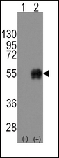CD14 Antibody - Western blot of CD14(arrow) using rabbit polyclonal CD14 Antibody. 293 cell lysates (2 ug/lane) either nontransfected (Lane 1) or transiently transfected with the CD14 gene (Lane 2) (Origene Technologies).
