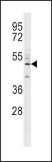 CD14 Antibody - CD14 Antibody western blot of A549 cell line lysates (35 ug/lane). The CD14 antibody detected the CD14 protein (arrow).