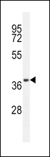 CD14 Antibody - CD14 Antibody western blot of A549 cell line lysates (35 ug/lane). The CD14 antibody detected the CD14 protein (arrow).