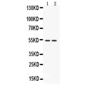 CD14 Antibody - Western blot analysis of CD14 expression in rat brain extract (lane 1) and mouse liver extract (lane 2). CD14 at 50 kD was detected using rabbit anti-CD14 Antigen Affinity purified polyclonal antibody at 0.5 ug/mL. The blot was developed using chemiluminescence (ECL) method.