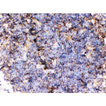CD14 Antibody - CD14 was detected in paraffin-embedded sections of mouse lymphadenoma tissues using rabbit anti- CD14 Antigen Affinity purified polyclonal antibody at 1 ug/mL. The immunohistochemical section was developed using SABC method.