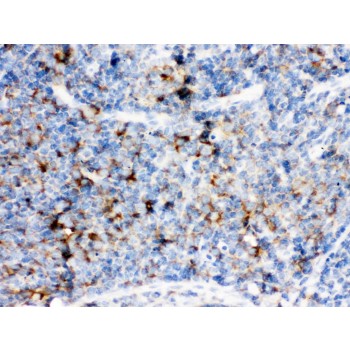 CD14 Antibody - CD14 was detected in paraffin-embedded sections of rat lymphadenoma tissues using rabbit anti- CD14 Antigen Affinity purified polyclonal antibody at 1 ug/mL. The immunohistochemical section was developed using SABC method.