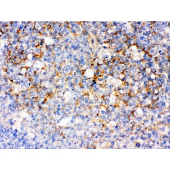 CD14 Antibody - CD14 was detected in paraffin-embedded sections of human tonsil tissues using rabbit anti- CD14 Antigen Affinity purified polyclonal antibody at 1 ug/mL. The immunohistochemical section was developed using SABC method.