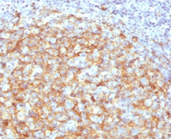 CD14 Antibody - IHC testing of FFPE human lymph node with CD14 antibody (clone CDLA14-2). HIER: boil tissue sections in 10mM Tris with 1mM EDTA, pH 9, for 10-20 min followed by cooling at RT for 20 min.
