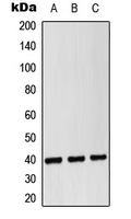 CD14 Antibody - Western blot analysis of CD14 expression in HEK293T (A); Raw264.7 (B); H9C2 (C) whole cell lysates.