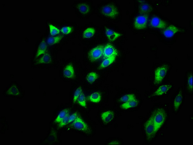 CD14 Antibody - Immunofluorescence staining of HepG2 cells with CD14 Antibody at 1:200, counter-stained with DAPI. The cells were fixed in 4% formaldehyde, permeabilized using 0.2% Triton X-100 and blocked in 10% normal Goat Serum. The cells were then incubated with the antibody overnight at 4°C. The secondary antibody was Alexa Fluor 488-congugated AffiniPure Goat Anti-Rabbit IgG(H+L).