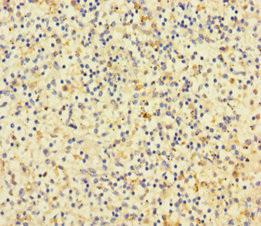 CD14 Antibody - Immunohistochemistry of paraffin-embedded human spleen tissue using CD14 Antibody at dilution of 1:100