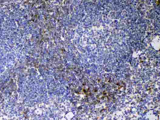 CD14 Antibody - Immunohistochemistry - Anti-CD14 Picoband Antibody