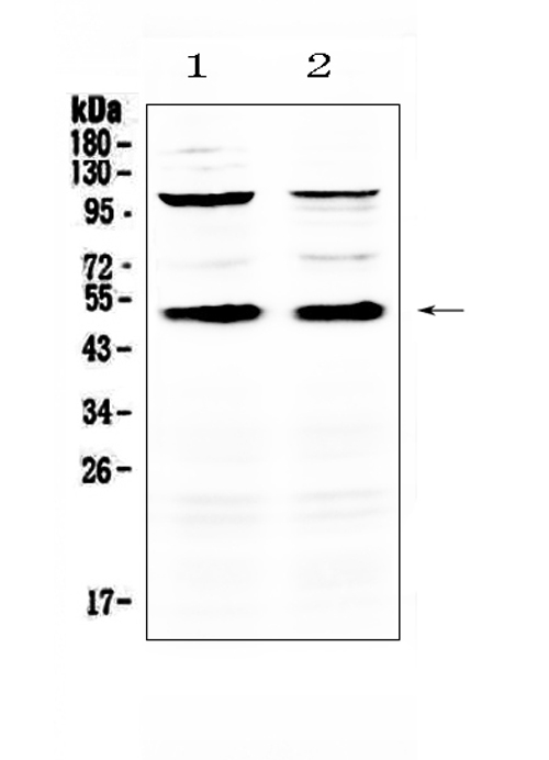 CD14 Antibody - Western blot analysis of CD14 using anti-CD14 antibody. Electrophoresis was performed on a 5-20% SDS-PAGE gel at 70V (Stacking gel) / 90V (Resolving gel) for 2-3 hours. The sample well of each lane was loaded with 50ug of sample under reducing conditions. Lane 1: mouse thymus tissue lysates,Lane 2: mouse spleen tissue lysates. After Electrophoresis, proteins were transferred to a Nitrocellulose membrane at 150mA for 50-90 minutes. Blocked the membrane with 5% Non-fat Milk/ TBS for 1.5 hour at RT. The membrane was incubated with rabbit anti-CD14 antigen affinity purified polyclonal antibody at 0.5 ug/mL overnight at 4?, then washed with TBS-0.1% Tween 3 times with 5 minutes each and probed with a goat anti-rabbit IgG-HRP secondary antibody at a dilution of 1:10000 for 1.5 hour at RT. The signal is developed using an Enhanced Chemiluminescent detection (ECL) kit with Tanon 5200 system. A specific band was detected for CD14 at approximately 50KD. The expected band size for CD14 is at 40KD.
