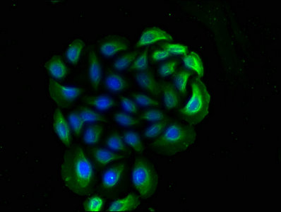 CD14 Antibody - Immunoflourescence staining of A549 cells at 1:90 dilution, counter-stained with DAPI. 