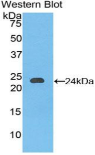 CD144 / CDH5 / VE Cadherin Antibody - Western blot of recombinant CD144 / CDH5 / VE Cadherin.  This image was taken for the unconjugated form of this product. Other forms have not been tested.
