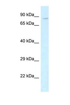 CD144 / CDH5 / VE Cadherin Antibody - CDH5 / VE Cadherin antibody Western blot of Fetal Heart lysate. Antibody concentration 1 ug/ml.  This image was taken for the unconjugated form of this product. Other forms have not been tested.