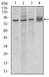 CD144 / CDH5 / VE Cadherin Antibody - Western blot using CDH5 mouse monoclonal antibody against MCF-7 (1), A549 (2), HUVE-12 (3) cell lysate, and rat lung (4) tissue lysate.