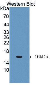 CD144 / CDH5 / VE Cadherin Antibody - Western blot of CD144 / CDH5 / VE Cadherin antibody.