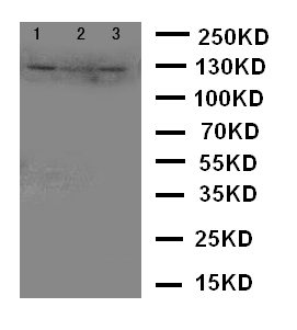 CD144 / CDH5 / VE Cadherin Antibody - WB of CD144 / CDH5 / VE Cadherin antibody. Lane 1: A549 Cell Lysate. Lane 2: HELA Cell Lysate. Lane 3: MCF-7 Cell Lysate.