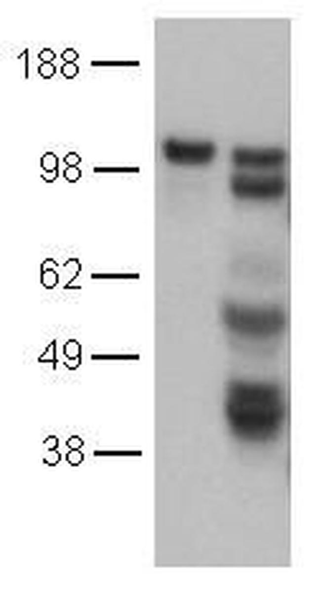 CD144 / CDH5 / VE Cadherin Antibody - CD144 (VE-cadherin) Antibody in Western Blot (WB)