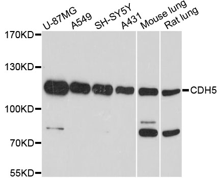 CD144 / CDH5 / VE Cadherin Antibody - Western blot analysis of extracts of various cell lines, using CDH5 antibody at 1:1000 dilution. The secondary antibody used was an HRP Goat Anti-Rabbit IgG (H+L) at 1:10000 dilution. Lysates were loaded 25ug per lane and 3% nonfat dry milk in TBST was used for blocking. An ECL Kit was used for detection and the exposure time was 90s.