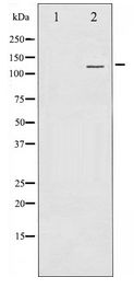 CD144 / CDH5 / VE Cadherin Antibody - Western blot of VE-Cadherin expression in Jurkat whole cell lysates,The lane on the left is treated with the antigen-specific peptide.