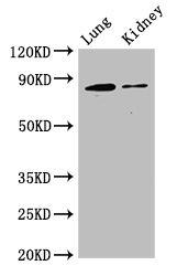 CD144 / CDH5 / VE Cadherin Antibody - Positive WB detected in:Mouse lung tissue,Mouse kidney tissue;All lanes:CDH5 antibody at 3ug/ml;Secondary;Goat polyclonal to rabbit IgG at 1/50000 dilution;Predicted band size: 88,75 kDa;Observed band size: 88 kDa;