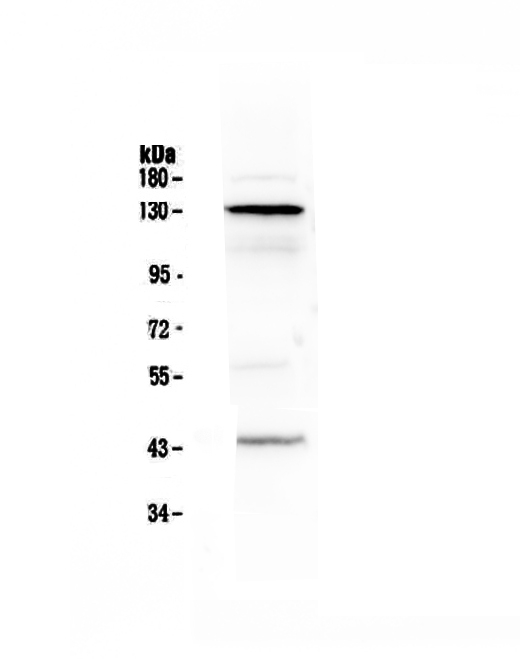 CD144 / CDH5 / VE Cadherin Antibody - Western blot - Anti-VE Cadherin Picoband antibody