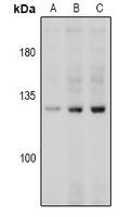 CD144 / CDH5 / VE Cadherin Antibody - Western blot analysis of CD144 (pY731) expression in Hela Starved 4h (A), Hela Starved 16h (B), Hela Starved 24h (C) whole cell lysates.