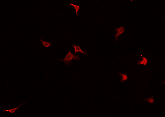 CD144 / CDH5 / VE Cadherin Antibody - Staining HuvEc cells by IF/ICC. The samples were fixed with PFA and permeabilized in 0.1% Triton X-100, then blocked in 10% serum for 45 min at 25°C. The primary antibody was diluted at 1:200 and incubated with the sample for 1 hour at 37°C. An Alexa Fluor 594 conjugated goat anti-rabbit IgG (H+L) antibody, diluted at 1/600, was used as secondary antibody.