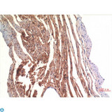 CD144 / CDH5 / VE Cadherin Antibody - Immunohistochemistry (IHC) analysis of paraffin-embedded Rat Heart Tissue using VE-Cadherin Mouse Monoclonal Antibody diluted at 1:200.