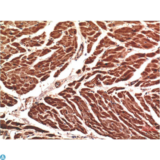 CD144 / CDH5 / VE Cadherin Antibody - Immunohistochemistry (IHC) analysis of paraffin-embedded Human Heart Tissue using VE-Cadherin Mouse Monoclonal Antibody diluted at 1:200.