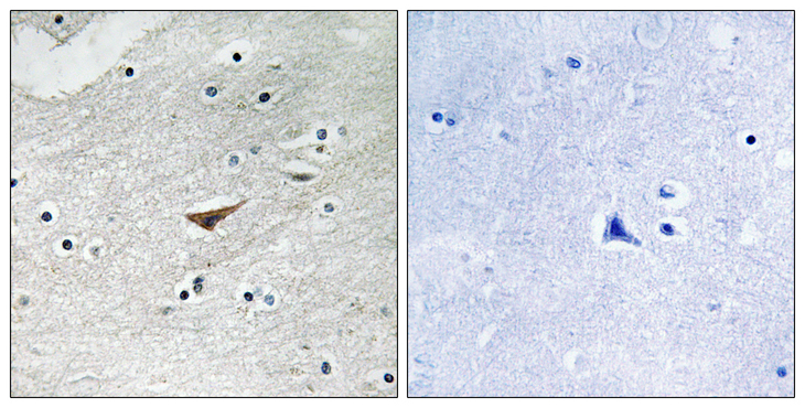 CD144 / CDH5 / VE Cadherin Antibody - Immunohistochemistry analysis of paraffin-embedded human brain, using VE-Cadherin (Phospho-Tyr731) Antibody. The picture on the right is blocked with the phospho peptide.