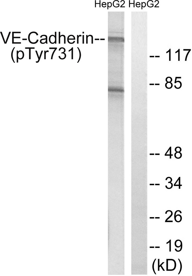 CD144 / CDH5 / VE Cadherin Antibody - Western blot analysis of lysates from HepG2 cells treated with Na3VO4 0.3mM 40', using VE-Cadherin (Phospho-Tyr731) Antibody. The lane on the right is blocked with the phospho peptide.