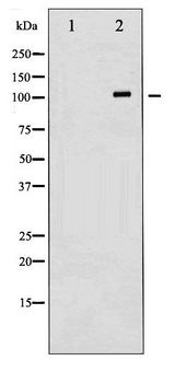 CD144 / CDH5 / VE Cadherin Antibody - Western blot of VE-Cadherin phosphorylation expression in Na3VO4 treated HepG2 whole cell lysates,The lane on the left is treated with the antigen-specific peptide.