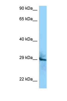 CD151 Antibody - CD151 antibody Western blot of A549 Cell lysate. Antibody concentration 1 ug/ml.  This image was taken for the unconjugated form of this product. Other forms have not been tested.