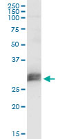CD151 Antibody - CD151 monoclonal antibody (M02), clone 1B2. Western Blot analysis of CD151 expression in human pancreas.