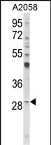 CD151 Antibody - Western blot analysis of CD151 Antibody (Center) in A2058 cell line lysates (35ug/lane). CD151 (arrow) was detected using the purified Pab.