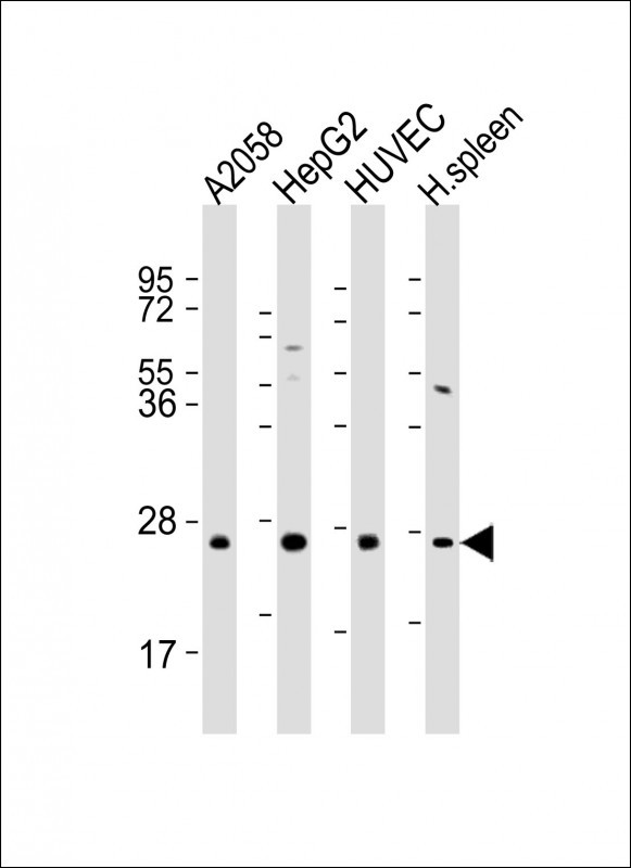 CD151 Antibody - All lanes: Anti-CD151 Antibody (Center) at 1:2000 dilution Lane 1: A2058 whole cell lysate Lane 2: HepG2 whole cell lysate Lane 3: HUVEC whole cell lysate Lane 4: human spleen lysate Lysates/proteins at 20 µg per lane. Secondary Goat Anti-Rabbit IgG, (H+L), Peroxidase conjugated at 1/10000 dilution. Predicted band size: 28 kDa Blocking/Dilution buffer: 5% NFDM/TBST.