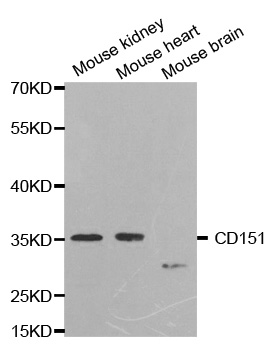 CD151 Antibody - Western blot analysis of extracts of various cell lines, using CD151 antibody.