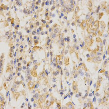 CD151 Antibody - Immunohistochemistry of paraffin-embedded human stomach using CD151 antibody at dilution of 1:200 (x400 lens)