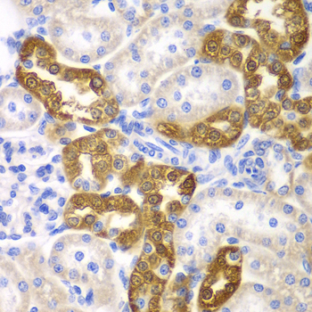 CD151 Antibody - Immunohistochemistry of paraffin-embedded rat kidney tissue.