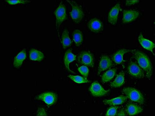 CD151 Antibody - Immunofluorescent analysis of A549 cells using CD151 Antibody at a dilution of 1:100 and Alexa Fluor 488-congugated AffiniPure Goat Anti-Rabbit IgG(H+L)