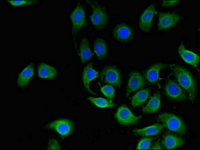 CD151 Antibody - Immunofluorescent analysis of A549 cells using CD151 Antibody at dilution of 1:100 and Alexa Fluor 488-congugated AffiniPure Goat Anti-Rabbit IgG(H+L)